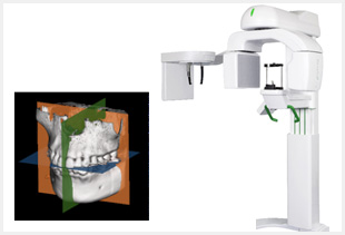 歯科用CT