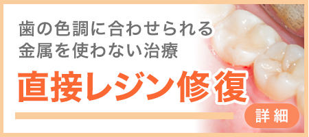 コンポジットレジン
